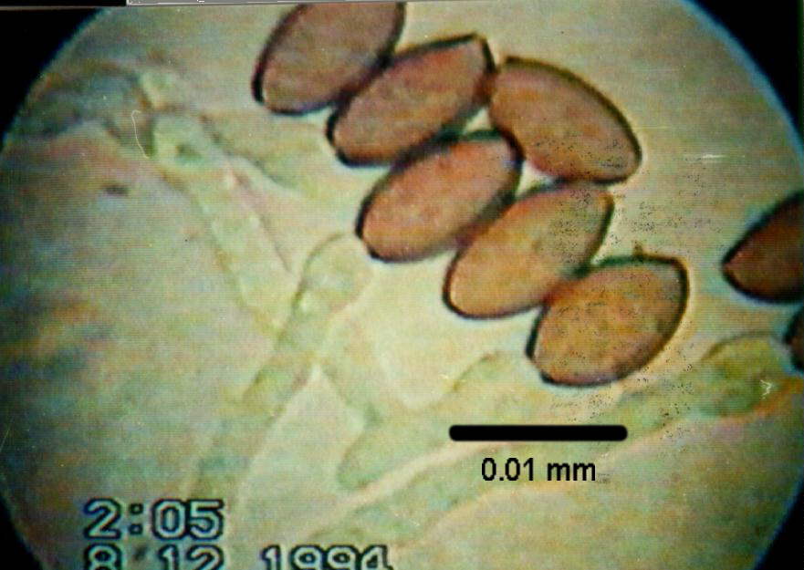 69K AO-Spores-2
